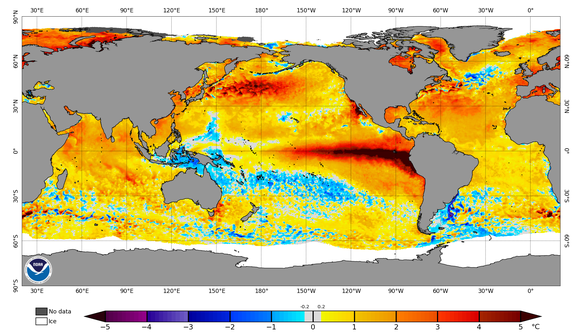 Vor der südamerikanischen Westküste weicht die Wasseroberflächentemperatur besonders stark ab (Stand: 4. Oktober 2026).