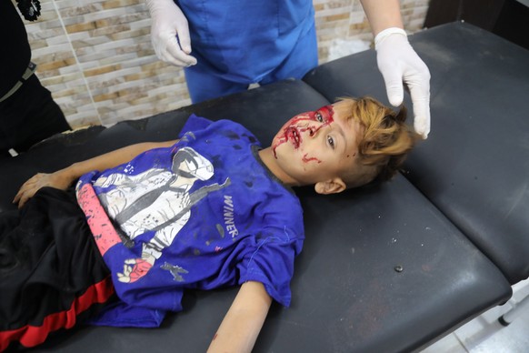 epaselect epa07919629 A wounded child injured in an alleged Turkish airstrike receives medical treatment at a hospital in Tal Tamr, northeastern of Syria, 13 October 2019 (issued 14 October 2019). Tur ...
