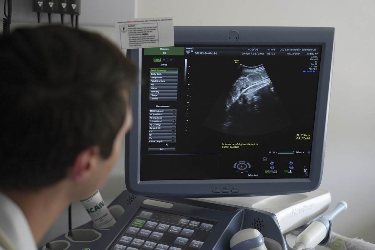 Dr. Jacob Lenz performs an ultrasound at the Oklahoma State University obstetrics and gynecology clinic in Tulsa, Okla., on Tuesday, July 16, 2024. (AP Photo/Mary Conlon)
