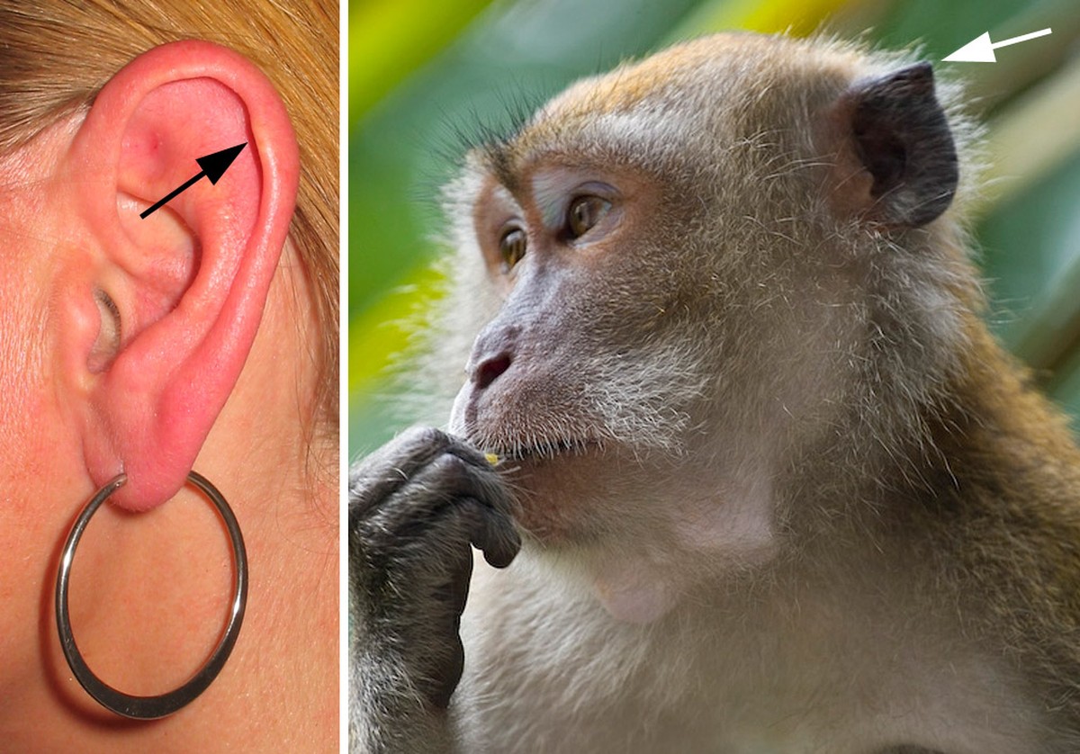 Ohrhöcker
Links: der Punkt, auf den der Pfeil zeigt, ist ein Darwin-Ohrhöcker. Rechts: Ein homologer Punkt bei einem Javaneraffen.
CC BY-SA 3.0, https://commons.wikimedia.org/w/index.php?curid=260521