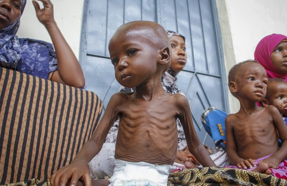 A malnourished two year-old sits by his mother, left, who was recently displaced by drought, at a malnutrition stabilization center run by Action against Hunger, in Mogadishu, Somalia Sunday, June 5,  ...