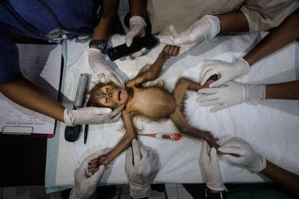 World Nature Photography Awards 2021: Nature Photojournalism, 1. Platz, Alain Schroeder, Belgium. Female orangutan aged 3 months, Sibolangit, SOCP Quarantine Centre, North Sumatra, Indonesia.