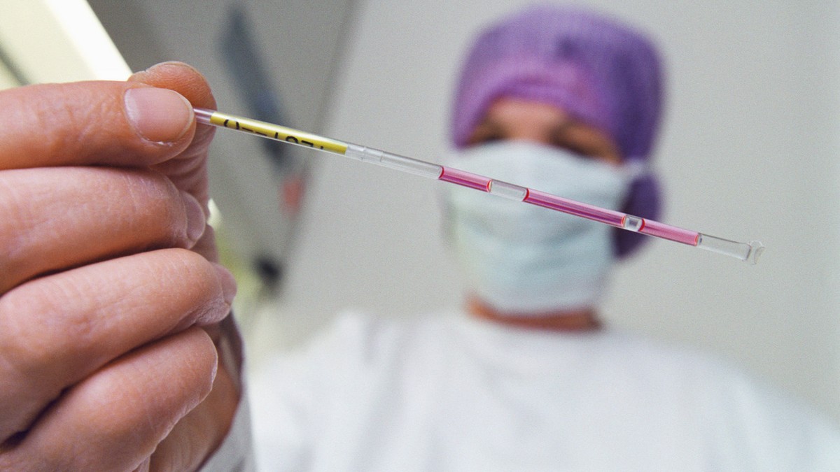 Die Leiterin des IVF-Labors (In-Vitro-Fertilisation) der Universitaets-Frauenklinik in Bern, Schweiz, zeigt eine Pailette mit befruchteten Eizellen, aufgenommen am 14. April 2004. (KEYSTONE/Gaetan Bal ...