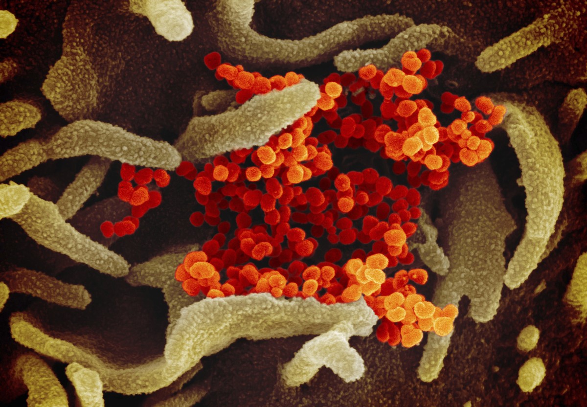 This undated electron microscope image made available by the U.S. National Institutes of Health in February 2020 shows the Novel Coronavirus SARS-CoV-2, orange, emerging from the surface of cells, gre ...