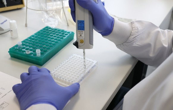 epa08996714 An employee works in a laboratory at Bioscientia Healthcare GmbH in Ingelheim, Germany, 08 February 2021. The largest medical laboratory in Rhineland-Palatinate, Bioscientia Healthcare Gmb ...