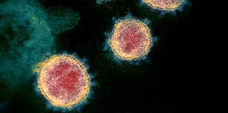Das weiss die Wissenschaft über das neue Coronavirus