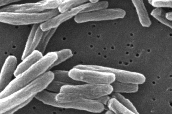 This 2006 electron microscope image provided by the Centers for Disease Control and Prevention shows Mycobacterium tuberculosis bacteria, which causes the disease tuberculosis. (Janice Carr/CDC via AP ...