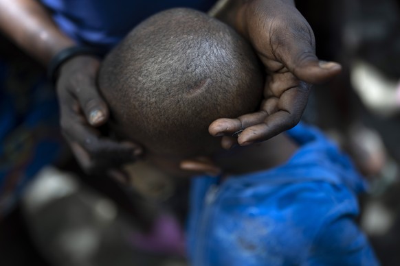 Lovely Benjamin holds the head of her 4-year-old son to show the scar left from a machete chop he received during a gang attack, in Port-au-Prince, Haiti, Sunday, June 4, 2023. While she and her littl ...