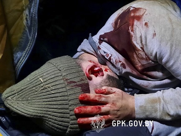 epa09574874 A handout picture made available by State Border Committee of the Republic of Belarus shows a migrant allegedly injured by Polish special force servicemen on the Belarusian-Polish border i ...