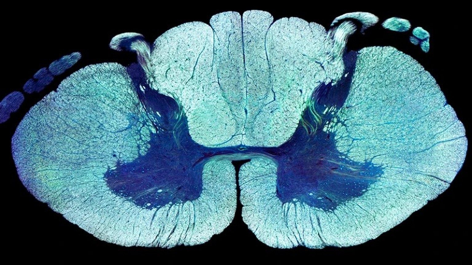 Spinal-cord injuries can be partially healed by remodelling of certain neurons.