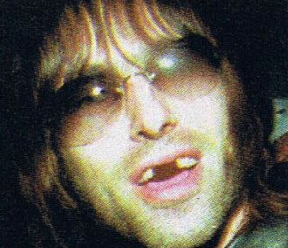 Vor 20 Jahren verlor Liam Gallagher seine Zähne bei einer Prügelei in München\nFaktencheck: