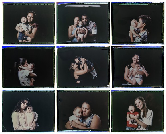 This combo of nine photos taken between Sept. 26 and 29, 2016, shows infants who were born with microcephaly, one of many serious medical problems caused by congenital Zika syndrome, photographed with ...