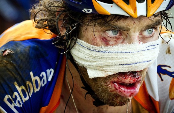 A photograph made available on 17 July of Dutch Rabo rider Laurens ten Dam is covered with blood after he crashed on the descent of the Col d'Agnes during the fourteenth stage of the Tour de Fran ...