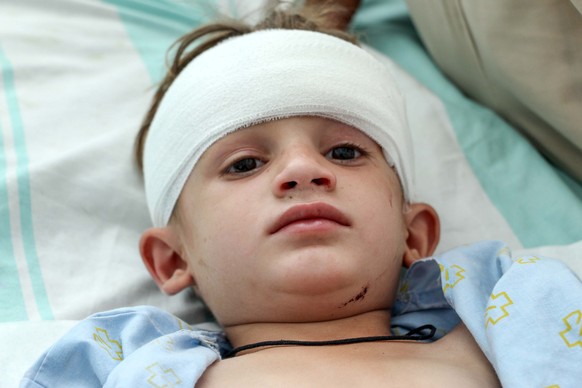 epa09325539 A boy who was injured in a car bomb blast, receives treatment at a hospital in Kandahar, Afghanistan, 06 July 2021. A car bomb exploded near a police center killing at least two police and ...