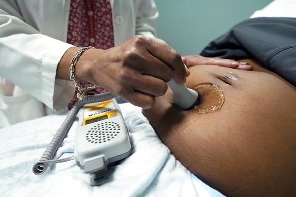 FILE - A doctor uses a portable Doppler probe on a pregnant woman to measure the fetal heart rate on December 1.  17, 2021, in Jackson, Mrs.  As the first bills trickle in for Louisiana's upcoming legislature…