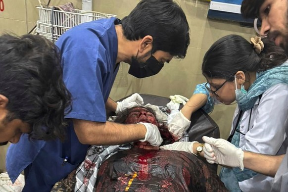 EDS NOTE: GRAPHIC CONTENT - In this photo released by the Inter Services Public Relations, a woman injured in a suspected Indian missile attack, receives treatment at a hospital in Bahawalpur, Pakista ...