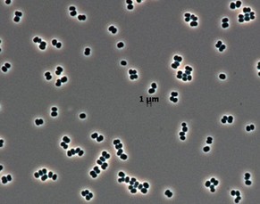 So sieht (stark vergrössert)&nbsp;Tersicoccus Phoenicis aus.