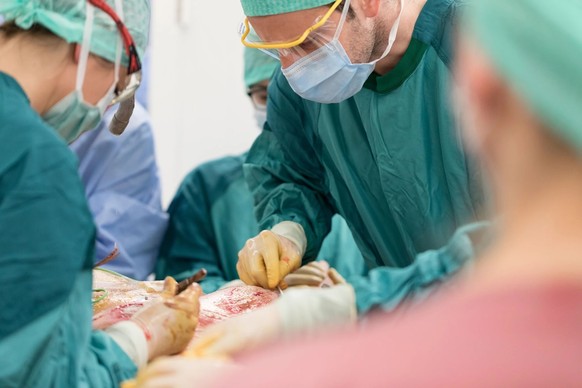 Die verbrannte Haut muss so schnell als möglich entfernt werden, um Zytokinstürme zu verhindern.