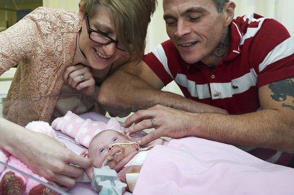 Naomi Findlay and Dean Wilkins, look at their daughter, three-week-old Vanellope Hope Wilkins who was born with an extremely rare condition in which the heart grows on the outside of the body, at Glen ...