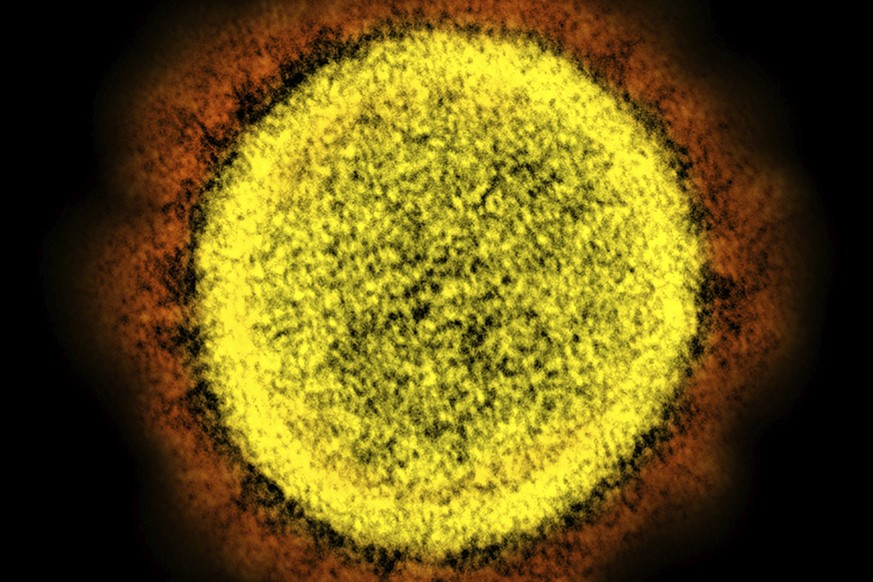 FILE - This 2020 electron microscope image made available by the National Institute of Allergy and Infectious Diseases shows a Novel Coronavirus SARS-CoV-2 particle isolated from a patient, in a labor ...