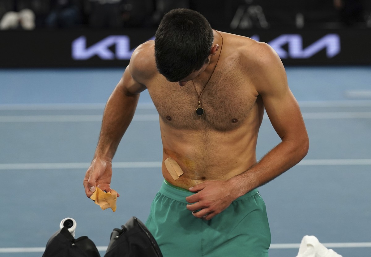 Serbia's Novak Djokovic takes a bandage off after defeating Russia's Daniil Medvedev in the men's singles final at the Australian Open tennis championship in Melbourne, Australia, Sunda ...