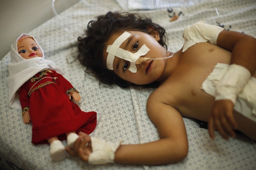 Dieses Kind hatte Glück: Verletztes Mädchen in einem Spital im Gazastreifen.