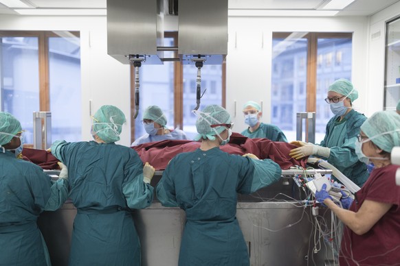 Doctors prepare a narcotized patient with burns before a surgical intervention, photographed at the intensive care unit of the University Hospital of Zurich, Switzerland, on January 17, 2017. (KEYSTON ...