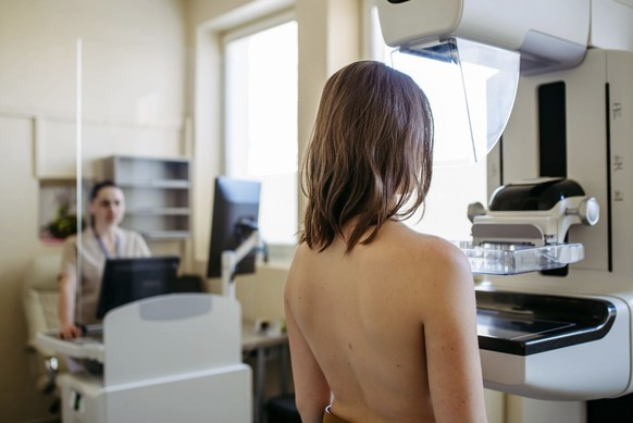 Eine Patientin steht vor einem Röntgenapparat, um eine Mammografie zu machen, ein Röntgenbild der Brust.