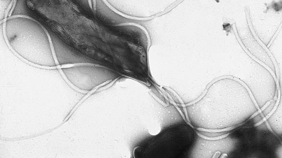 Global Study: 12% of Cancer Cases Linked to Infections