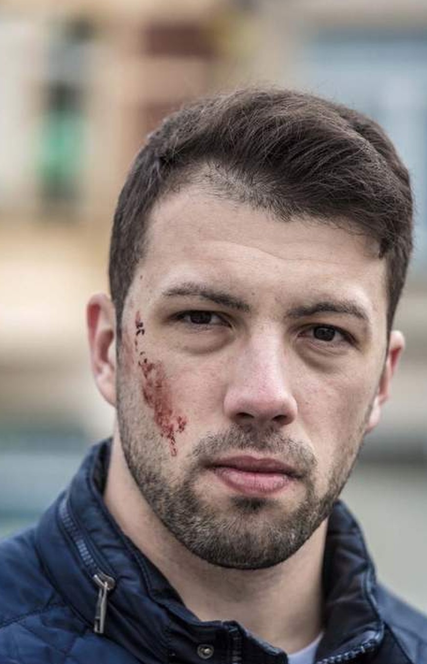 Augenzeugen berichten: «Überall war Blut. Es war entsetzlich»