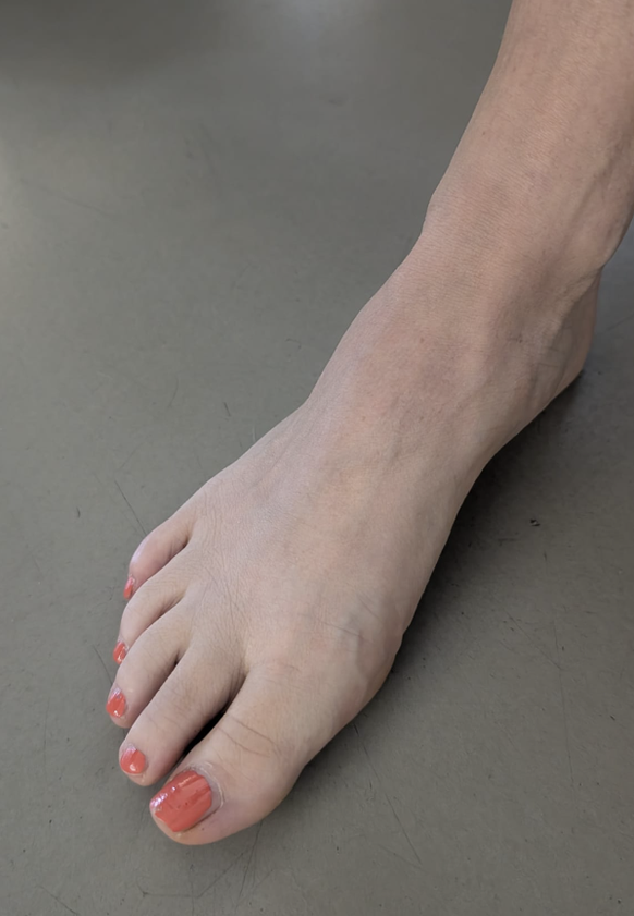 Flipflop oder nicht? das sind die schönsten Watson Füsse