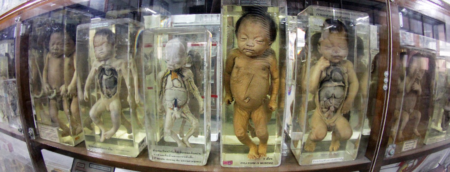 Föten im&nbsp;Siriraj Medical Museum.