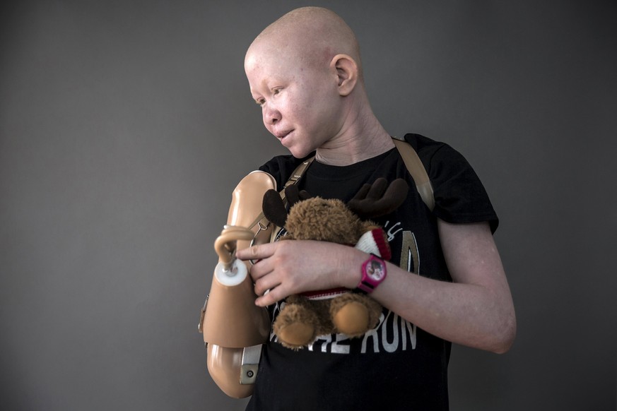 Pendo Sengerema, âgée de 15 ans, perdit son bras dans une attaque. Elle pose ici avec la peluche qui la réconforte la nuit et lui donne un semblant de sentiment de sécurité.