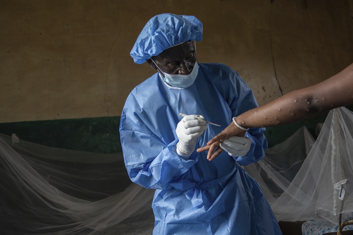 Atumisi Anaclet treats a sex worker with mpox on Sept. 4, 2024, in a hospital in Kamituga, in eastern Congo's South Kivu province, which is the epicenter of the world's latest outbreak of th ...