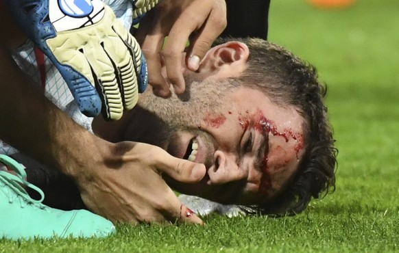 Turkey&#039;s Gokhan Gonul sits on the pitch after suffering a cut during the Euro 2016 Group D soccer match between the Czech Republic and Turkey at the Bollaert stadium in Lens, France, Tuesday, Jun ...