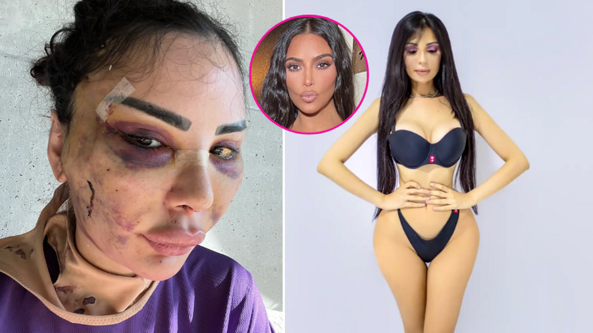 Elle dépense 600'000 dollars pour ressembler à Kim Kardashian