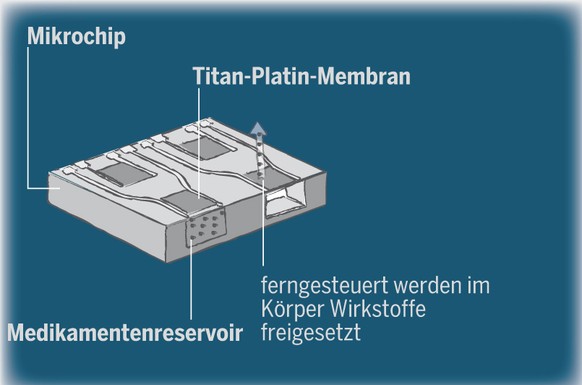 In einem Chip sind in verschiedenen Reservoirs kleine Medikamentendosierungen untergebracht. Durch einen kleinen Stromstoss öffnet sich die Membran über dem Reservoir, sodass der Wirkstoff freigesetzt ...