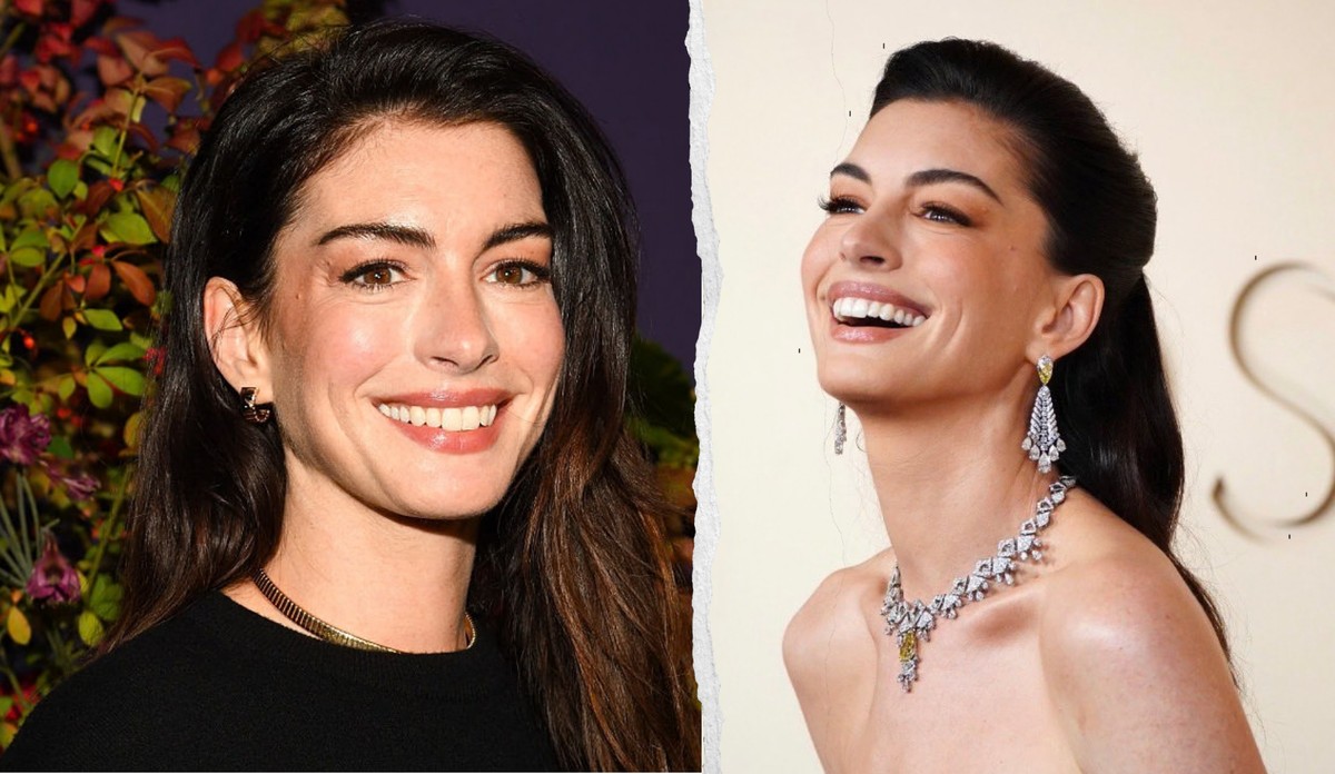 Le visage de l'actrice aux Oscars a fasciné la Toile.