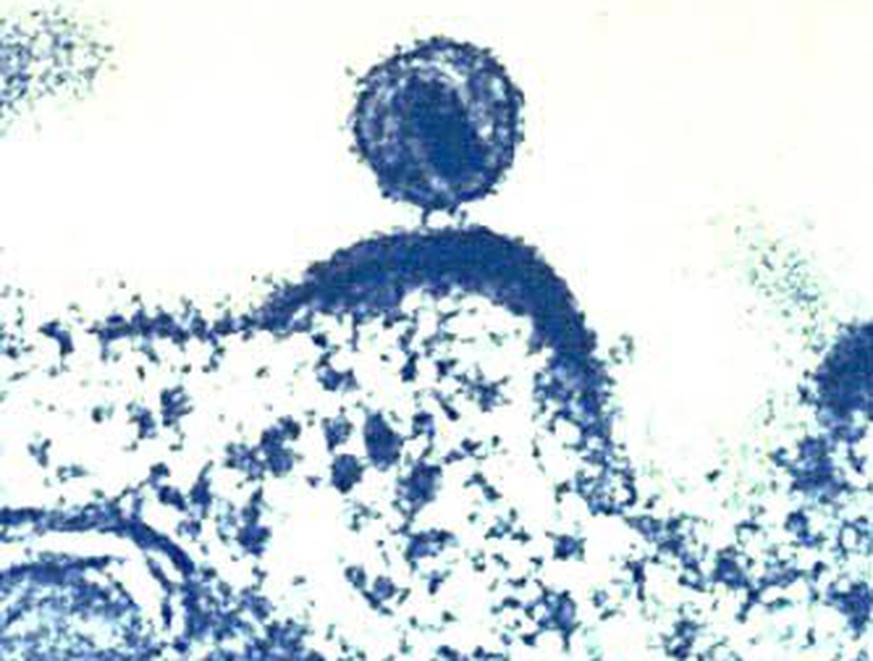 HI-Virus, das sich aus einer Immunzelle herauslöst.
