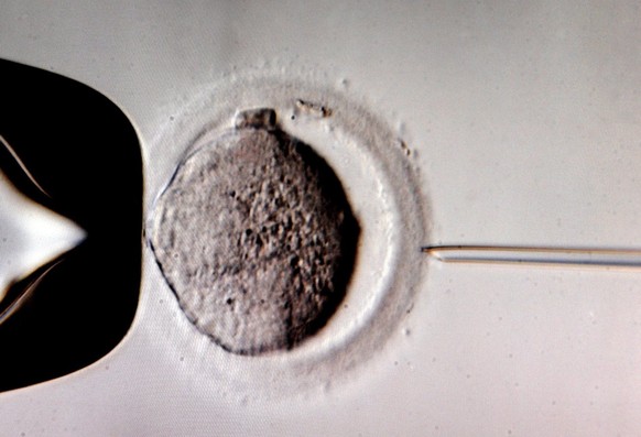 epa02811658 A monitor shows the microinjection of sperm into an egg cell using a microscope at the in vitro fertilization clinic, Kinderwunschzentrum Leipzig, in Leipzig, Germany, 05 July 2011. The ce ...