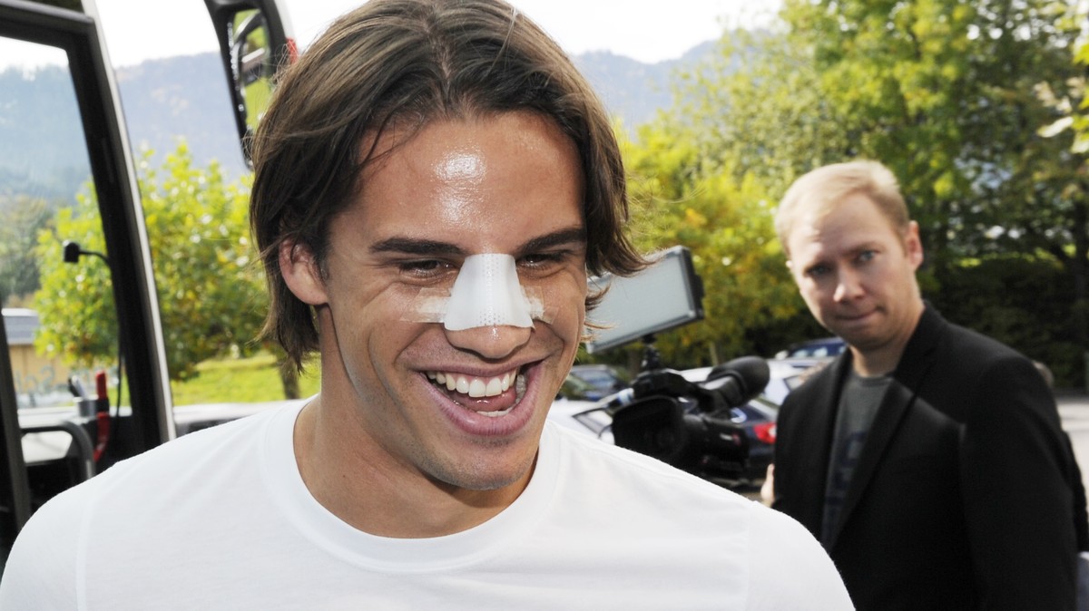 Die Nase der Nation? Die grosse Frage vor dem Spiel gegen San Marino lautet, ob Torhüter Yann Sommer mit seiner gebrochenen Nase auflaufen kann. Torhüter-Probleme gegen SAN MARINO?