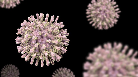HIV model HI-Virus Aids