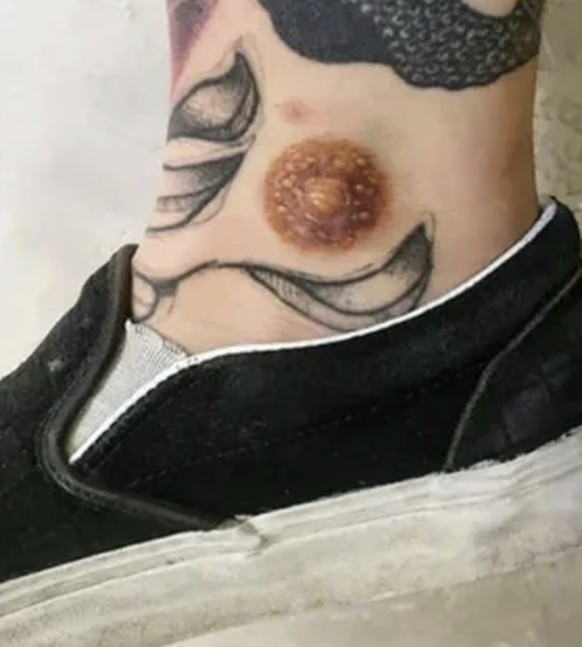 Die lustigsten Fails: Tattoo der Woche