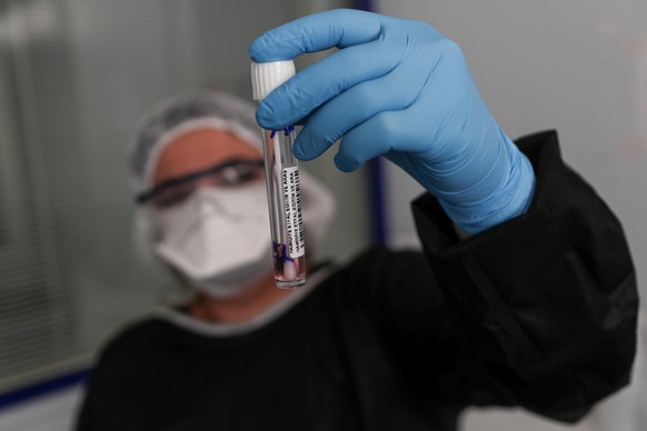 epa08437710 A health worker displays a vial containing a swab sample while conducting COVID-19 tests at the Istanbul Sisli Hamidiye Etfal Training and Research Hospital, in Istanbul, Turkey, 20 May 20 ...