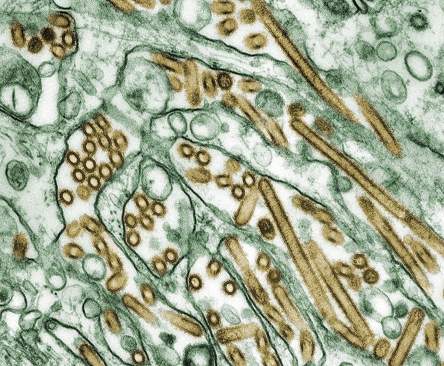 Elektronenmikroskopische Aufnahme von A/H5N1 (Virus ist golden angefärbt)
https://de.wikipedia.org/wiki/Gefl%C3%BCgelpest#/media/Datei:Colorized_transmission_electron_micrograph_of_Avian_influenza_A_H ...