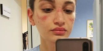 Appell von italienischer Pflegerin: «Vereitelt unsere Bemühungen nicht!»