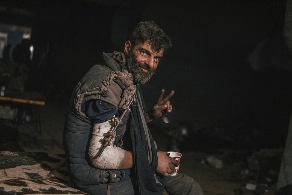 In this photo provided by Azov Special Forces Regiment of the Ukrainian National Guard Press Office, an Azov Special Forces Regiment's serviceman, injured during fighting against Russian forces,  ...