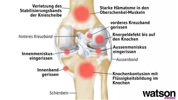 Ansicht eines Knies von hinten.