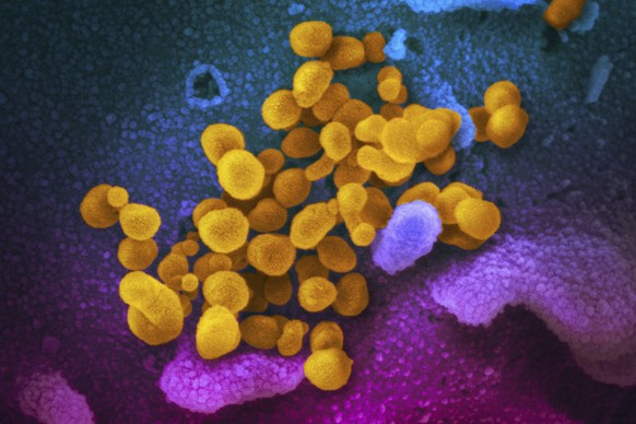 FILE - This undated, colorized electron microscope image made available by the U.S. National Institutes of Health in February 2020 shows the Novel Coronavirus SARS-CoV-2, indicated in yellow, emerging ...