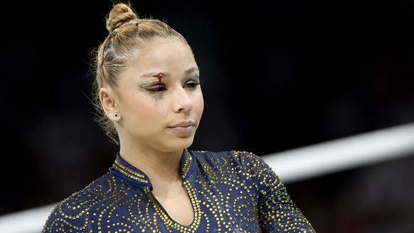 epaselect epa11509623 Flavia Saraiva of Brazil has a small cut above her eye following a fall in the warm-up before the Women Team final of the Artistic Gymnastics competitions in the Paris 2024 Olymp ...